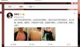 樊昊仑爆料赫子铭视频,真相背后引人深思