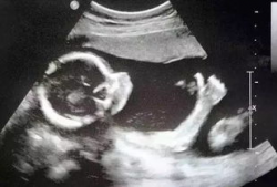 网友爆料医院b超室视频,网友曝光真实工作场景